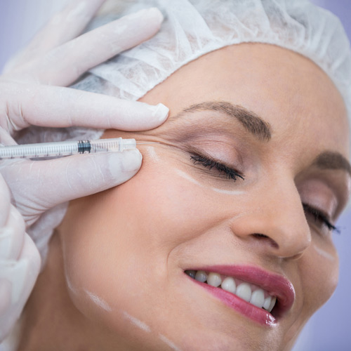 Botox Full face